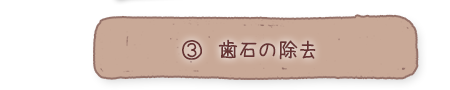 3.歯石の除去